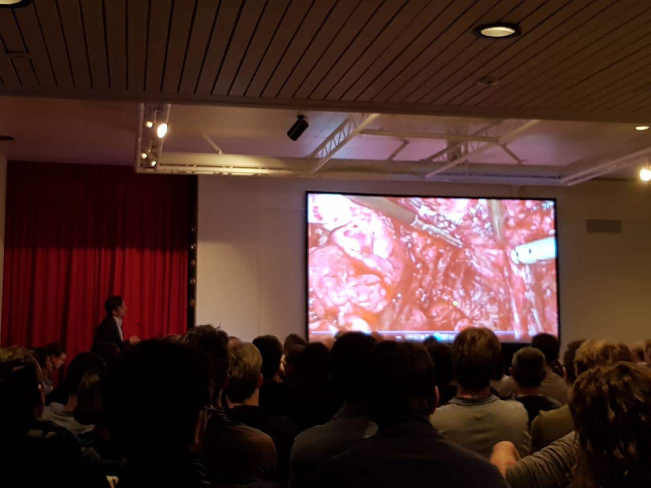 اندومتریوز رکتوم ارایه در کنفرانس سوئیس 